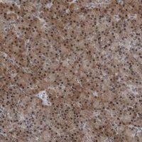 Anti-AKR1A1 antibody produced in rabbit 