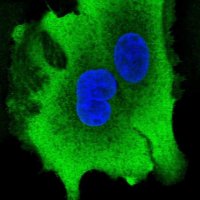 Anti-AKR1B10 antibody produced in rabbit 