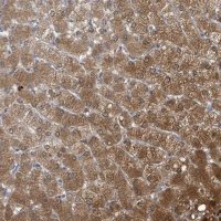 Anti-AKR1C4 antibody produced in rabbit 