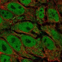 Anti-AKR1E2 antibody produced in rabbit 