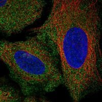 Anti-AKR7A2 antibody produced in rabbit 