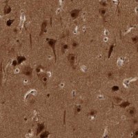 Anti-AKT3 antibody produced in rabbit 