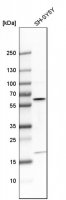Anti-AKT3 antibody produced in rabbit