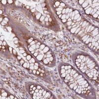 Anti-AKTIP antibody produced in rabbit 