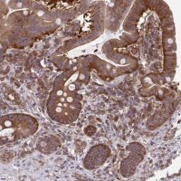 Anti-ALDH16A1 antibody produced in rabbit 