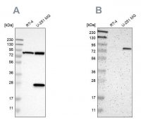 Anti-ALDH18A1 antibody produced in rabbit 