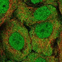 Anti-ALDH1A3 antibody produced in rabbit 