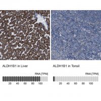 Anti-ALDH1B1 antibody produced in rabbit 