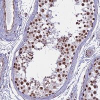 Anti-ALG10 antibody produced in rabbit HPA043329-100UL
