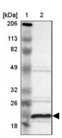 Anti-ALG13 antibody produced in rabbit