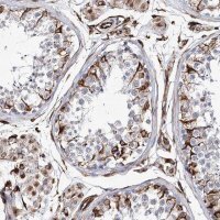 Anti-ALG1L antibody produced in rabbit 