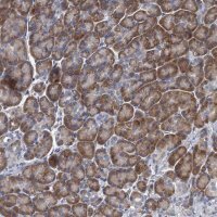 Anti-ALG2 antibody produced in rabbit HPA041601-100UL