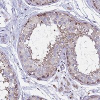 Anti-ALG3 antibody produced in rabbit