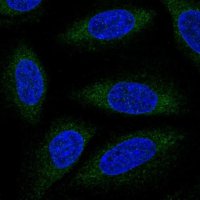 Anti-ALG6 antibody produced in rabbit 
