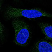 Anti-ALG9 antibody produced in rabbit