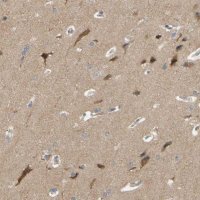 Anti-ALK antibody produced in rabbit 