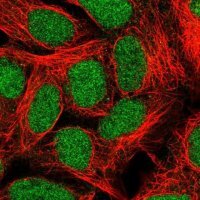 Anti-ALKBH2 antibody produced in rabbit 