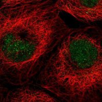 Anti-ALKBH3 antibody produced in rabbit 