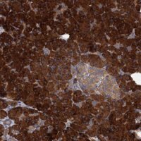 Anti-ALKBH7 antibody produced in rabbit 