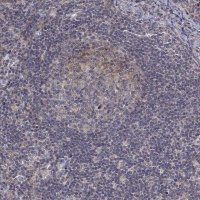 Anti-ALKBH8 antibody produced in rabbit 