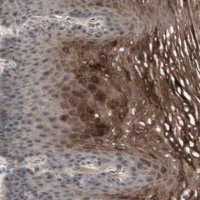 Anti-ALOX12 antibody produced in rabbit 