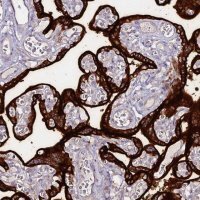 Anti-ALPP antibody produced in rabbit