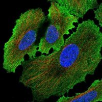 Anti-ALPP antibody produced in rabbit