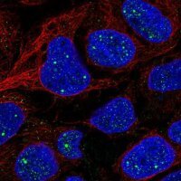 Anti-AMER1 antibody produced in rabbit 