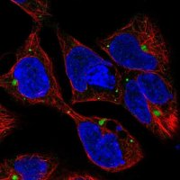 Anti-AMH antibody produced in rabbit 