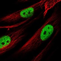 Anti-AMIGO1 antibody produced in rabbit HPA046152-100UL