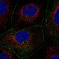 Anti-AMOTL2 antibody produced in rabbit 