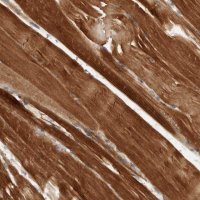 Anti-AMPD1 antibody produced in rabbit 