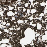 Anti-ANK1 antibody produced in rabbit 
