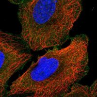 Anti-ANK3 antibody produced in rabbit 