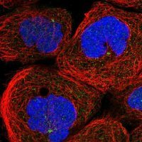 Anti-ANKAR antibody produced in rabbit 