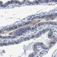 Anti-ANKFN1 antibody produced in rabbit 