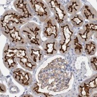 Anti-ANKFY1 antibody produced in rabbit HPA024513-100UL