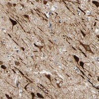 Anti-ANKHD1 antibody produced in rabbit 