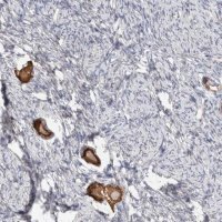 Anti-ANKMY1 antibody produced in rabbit 