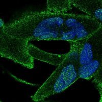 Anti-ANKRA2 antibody produced in rabbit 