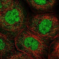 Anti-ANKRD11 antibody produced in rabbit 