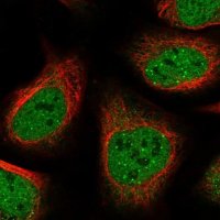 Anti-ANKRD12 antibody produced in rabbit 