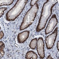 Anti-ANKRD13D antibody produced in rabbit 