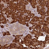 Anti-ANKRD18A antibody produced in rabbit 