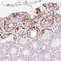 Anti-ANKRD20A4 antibody produced in rabbit 