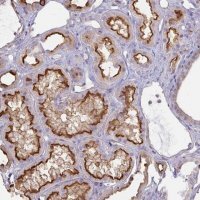 Anti-ANKRD33 antibody produced in rabbit 
