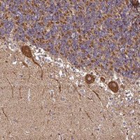 Anti-ANKRD33B antibody produced in rabbit 