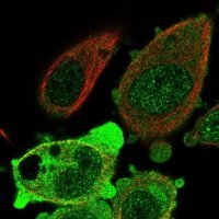 Anti-ANKRD36 antibody produced in rabbit 