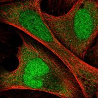 Anti-ANKRD36C antibody produced in rabbit 
