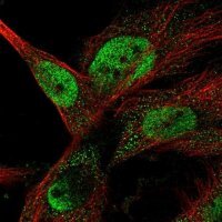 Anti-ANKRD42 antibody produced in rabbit 